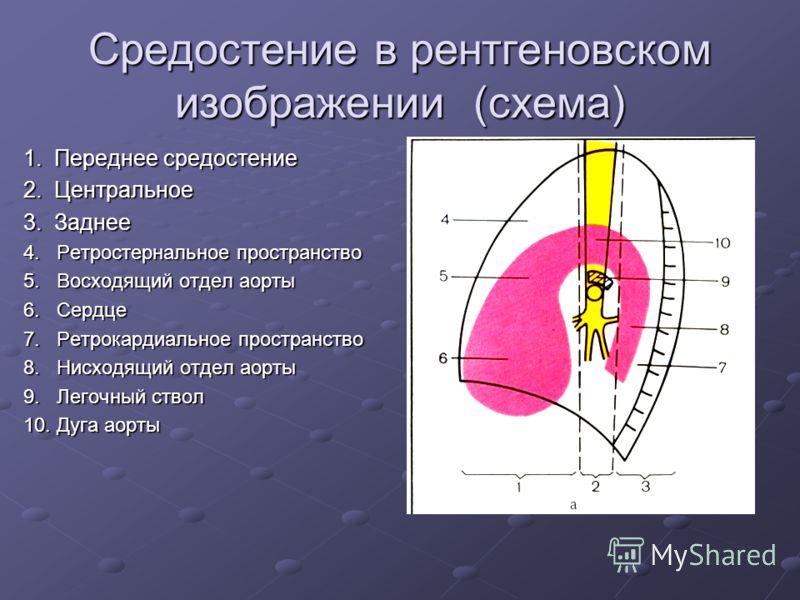 Верхняя стенка средостения