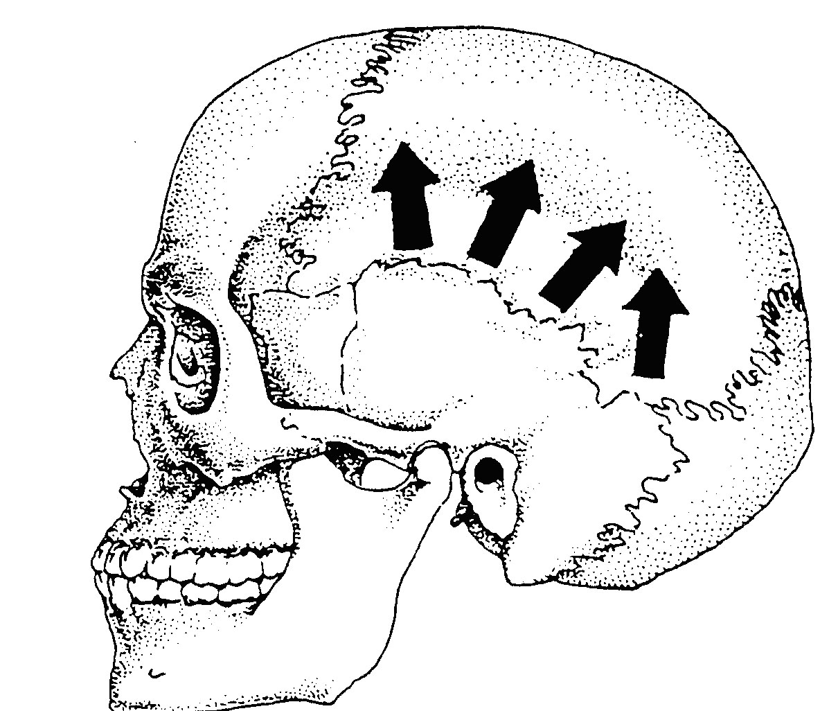 Теменная область кость. Теменная череп. Теменная зона черепа. Строение черепа теменная. Теменная часть головы анатомия.