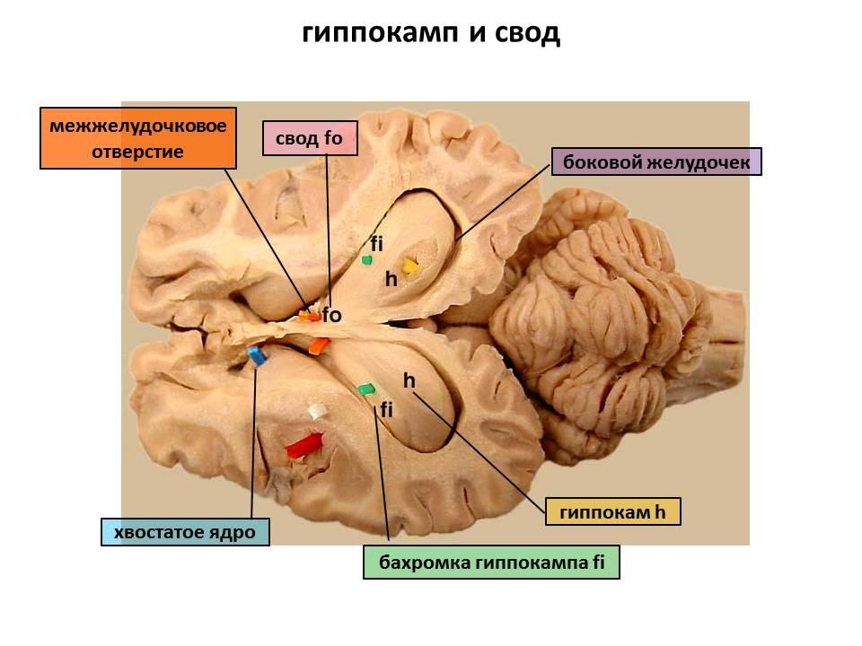 Свод головного мозга. Гиппокамп головного мозга анатомия. Свод мозга анатомия. Гиппокамп препарат мозга анатомия. Межжелудочковое отверстие.