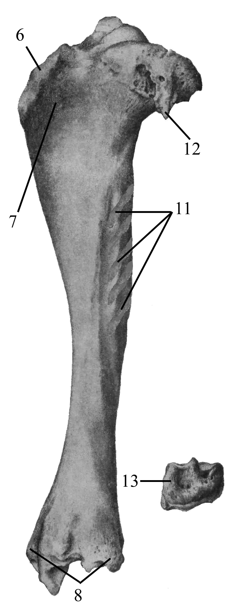 Малая берцовая кость где находится у человека фото на ноге перелом