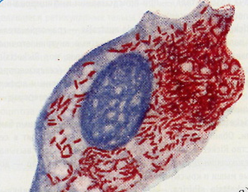 микоплазма внутри клеток 