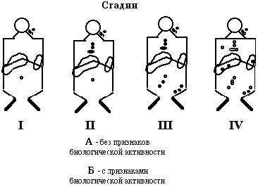 Эритремия (болезнь Вакеза, полицитемия)
