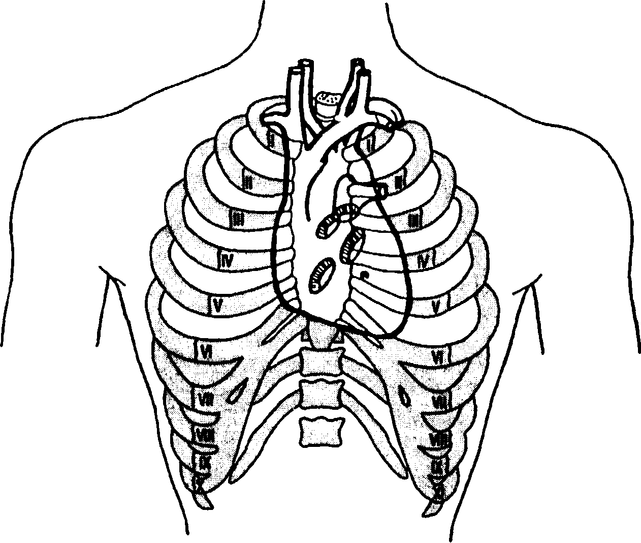 Клапаны сердца на грудной клетке. Межреберья грудной клетки. Грудная клетка человека межреберья. Топография выслушивания клапанов сердца. Грудная клетка человека анатомия межреберье.