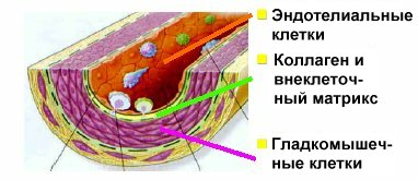 Роль липопротеидов в развитии атеросклероза thumbnail