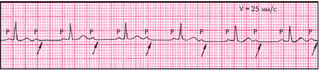#ЭКГ #тест@medic_ecg #ЭКГшка@medic_ecg #ЭКГшка1067@medic_ecg #ЭКГ_каждый_день@me