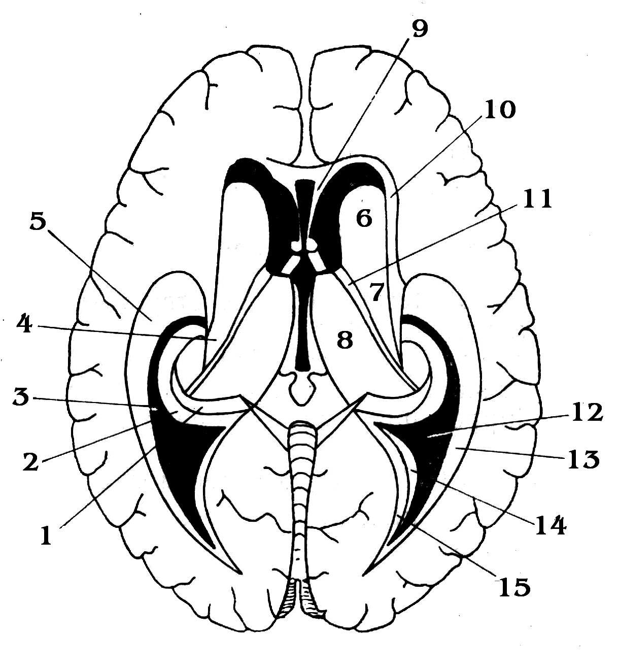 Схема рогов. Боковые желудочки горизонтальный срез. Желудочки головного мозга анатомия. Схема желудочков головного мозга. Желудочки мозга горизонтальный разрез.