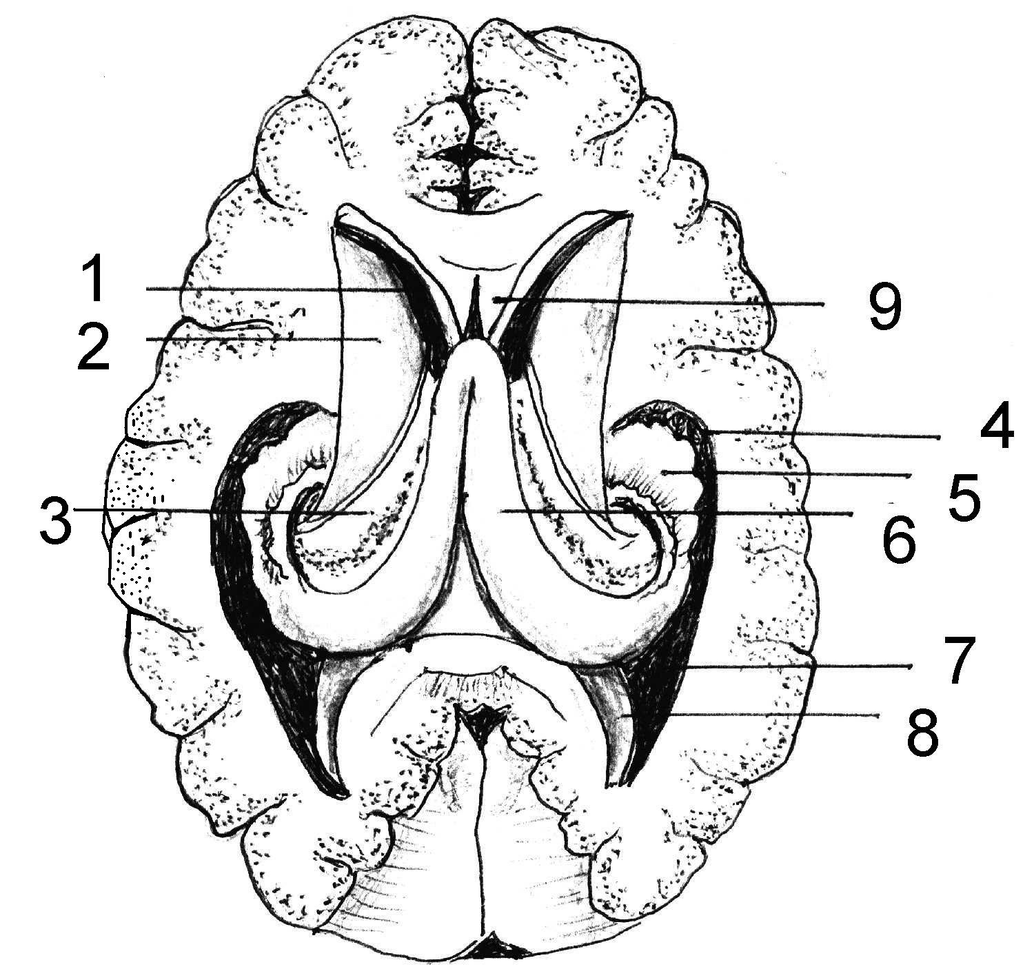 Правый желудочек головного. Боковые желудочки головного мозга схема. Проекция желудочков головного мозга. Отделы бокового желудочка мозга. Боковые желудочки мозга рога.