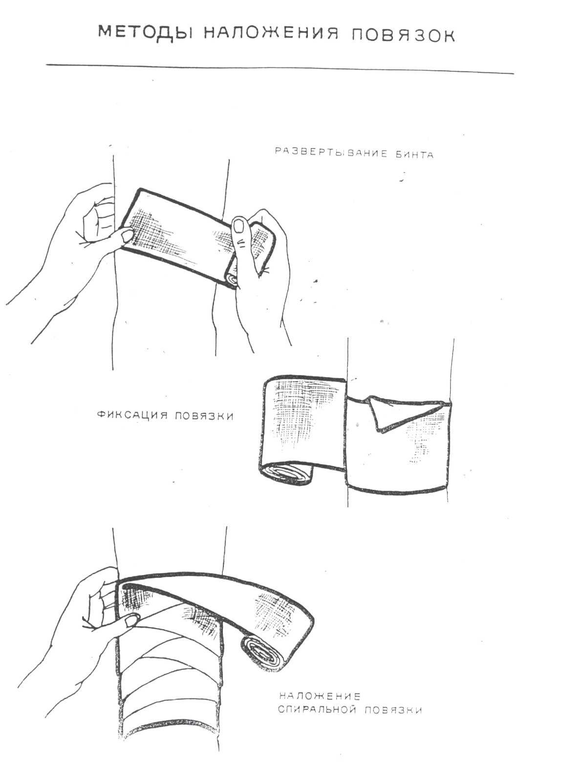 Способ закрепления перевязочного материала. Складывание перевязочного материала. Приготовление перевязочного материала. Изготовление перевязочного материала алгоритм.
