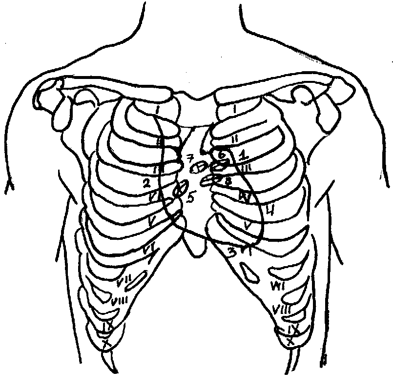 Клапаны сердца на грудной клетке. Топография сердца скелетотопия. Границы сердца скелетотопия. Топография сердца межреберья. Скелетотопия клапанов сердца.