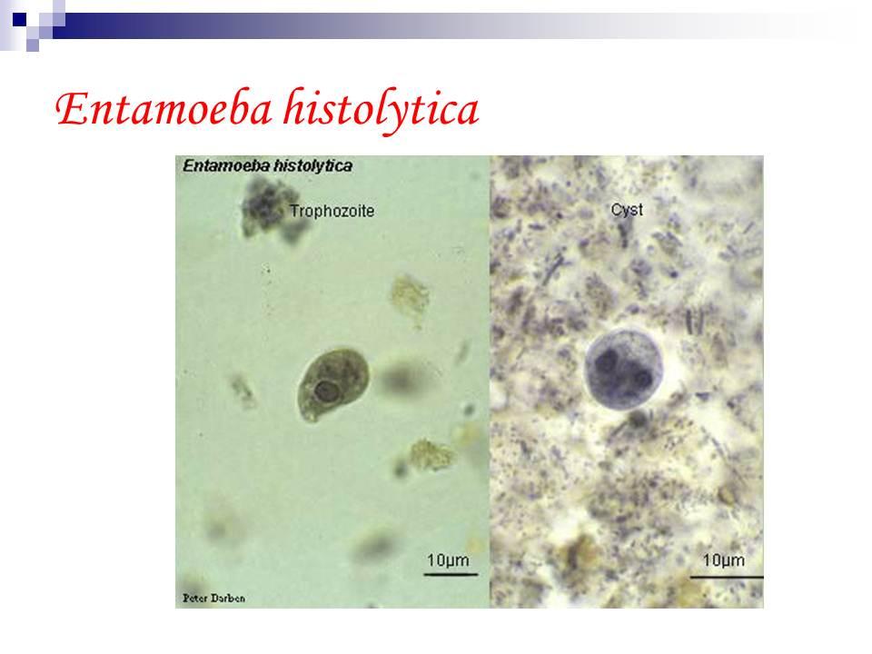 Entamoeba coli в кале. Entamoeba histolytica циста. Entamoeba histolytica препарат. Entamoeba histolytica под микроскопом. Entamoeba histolytica trophozoite.