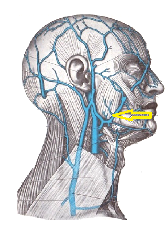 Нарушение венозного оттока шеи. Наружная яремная Вена анатомия. Внутренняя яремная Вена анатомия схема. Поверхностная яремная Вена анатомия. Наружная яремная Вена (v. jugularis externa).