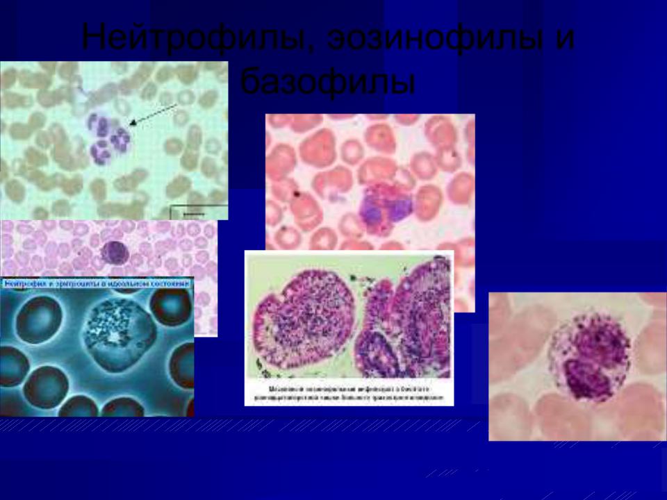 Эозинофилы в крови 0. Эозинофилы цвет цитоплазмы. Эозинофилы место отмирания. Грибковые инфекции и эозинофилы. Эозинофилы 2.