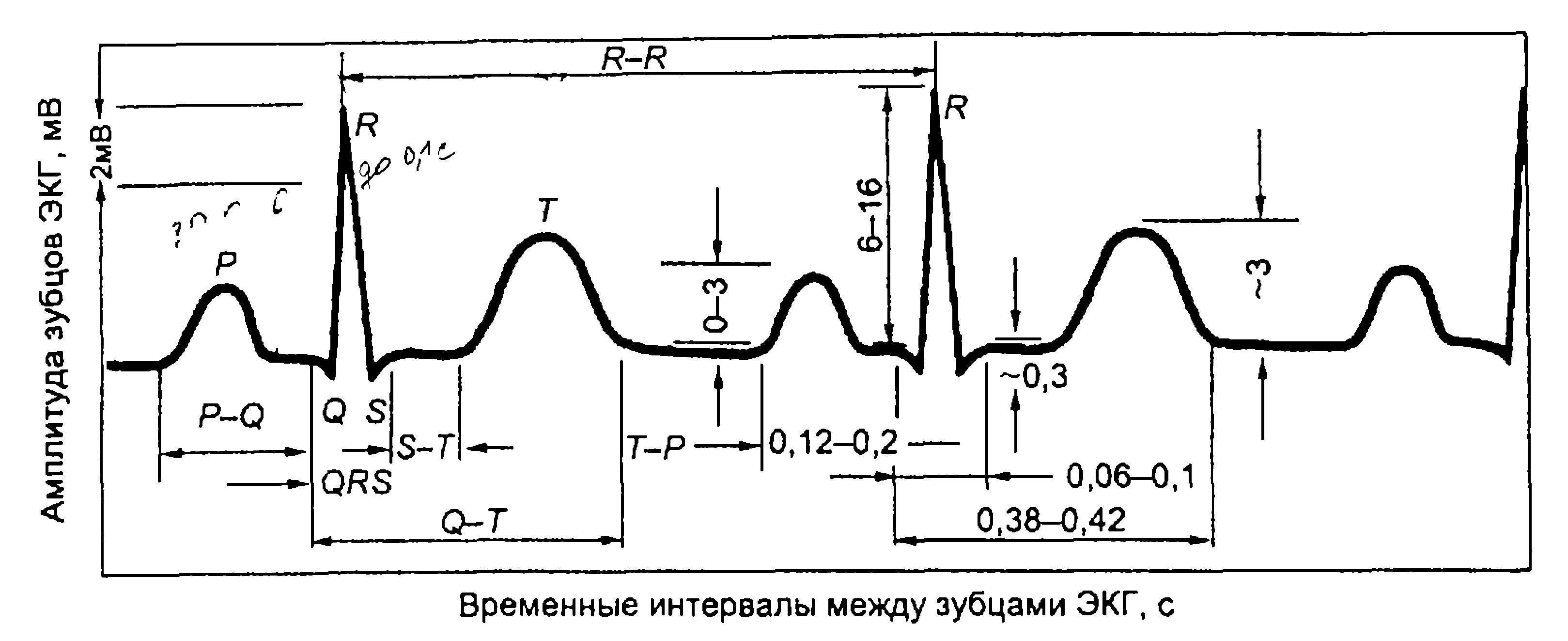 На рисунке изображен фрагмент электрокардиограммы человека