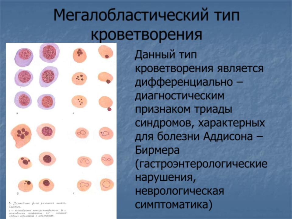 Картина крови при болезни аддисона бирмера в стадию рецидива