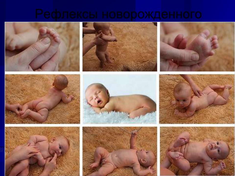 Врожденные рефлексы новорожденных