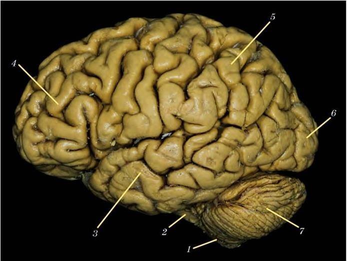 Центральная извилина мозга. Препарат головного мозга анатомия. Латеральная борозда головного мозга. Конечный мозг анатомия препарат.