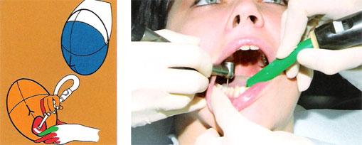Деонтологические принципы при лечении кариеса и некариозных поражений зубов