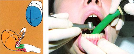Деонтологические принципы при лечении кариеса и некариозных поражений зубов