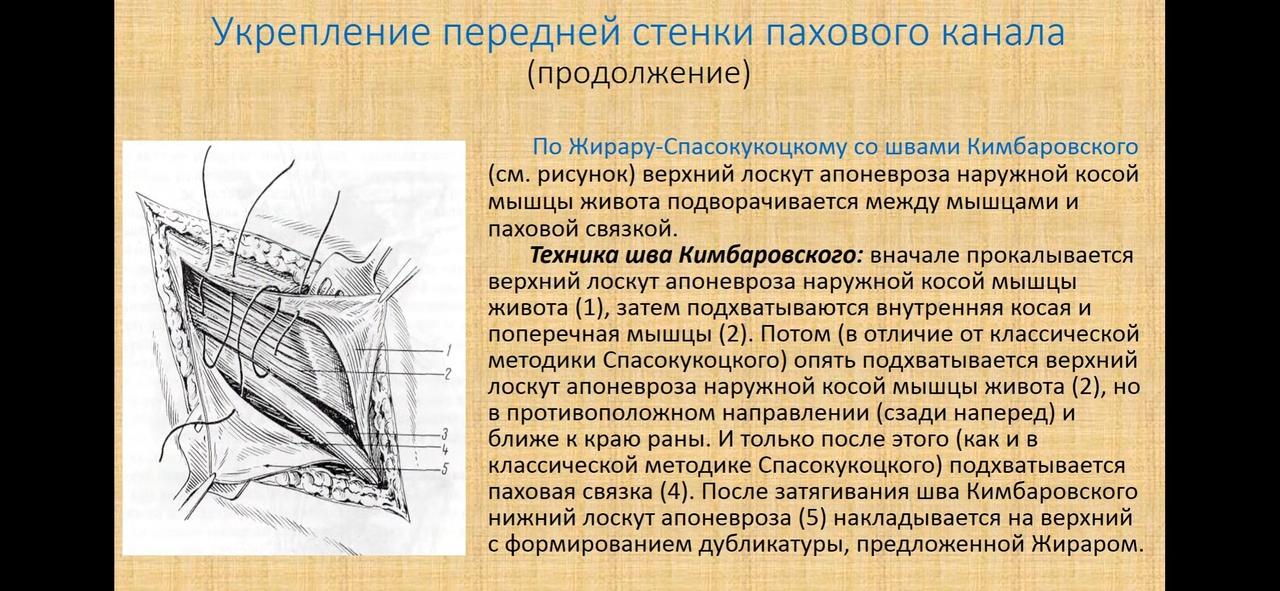 Паховый канал Паховый канал