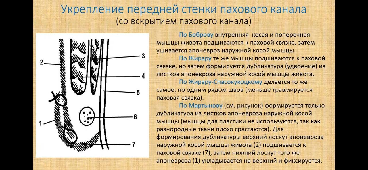 Паховый промежуток Паховый промежуток