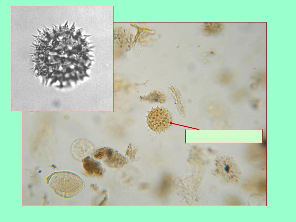 Пыльца и споры. Спорово-пыльцевой метод. Споро-пыльцевой. Пыльца микроскопия атлас. Пыльца микроскопия палинология.