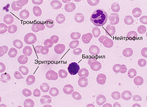 Эритремия