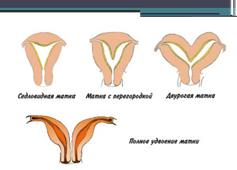 Виды матки у женщин какие бывают фото и названия