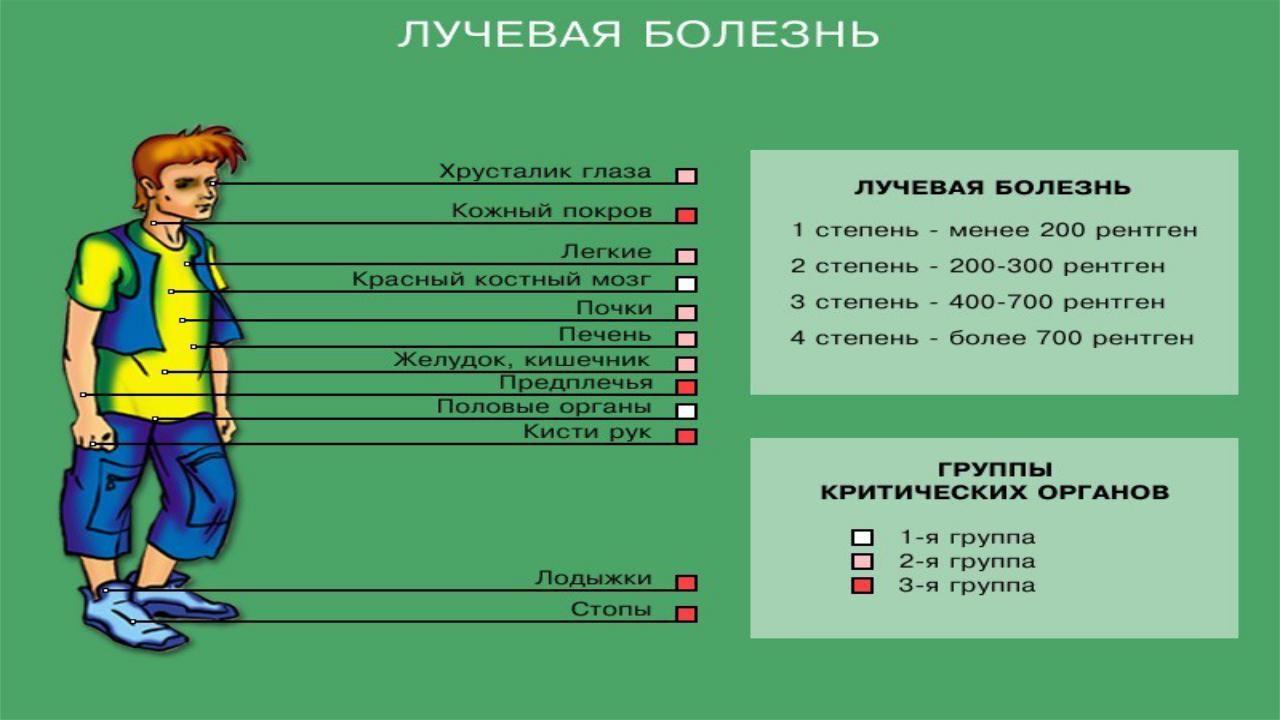 Лучевая болезнь Лучевая болезнь