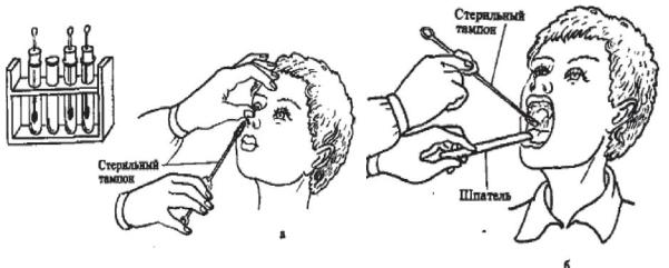 Взятие мазка из зева ребенка