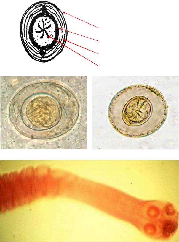 Карликовый цепень строение. Карликовый цепень (Hymenolepis Nana). Онкосфера карликовый цепень. Онкосфера свиного цепня. Яйца свиного цепня микроскоп.