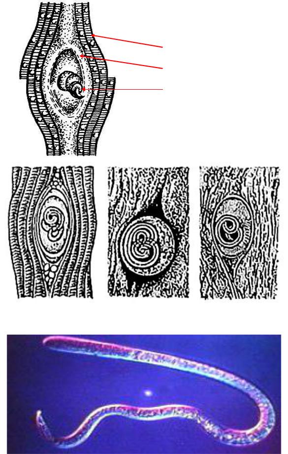 Личинки трихинеллы. Инкапсулированная личинка трихинеллы строение. Trichinella spiralis инкапсулированная личинка.