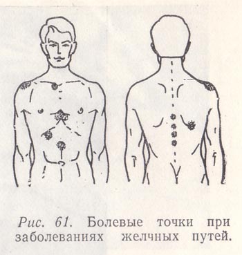 Пальпация желчного пузыря