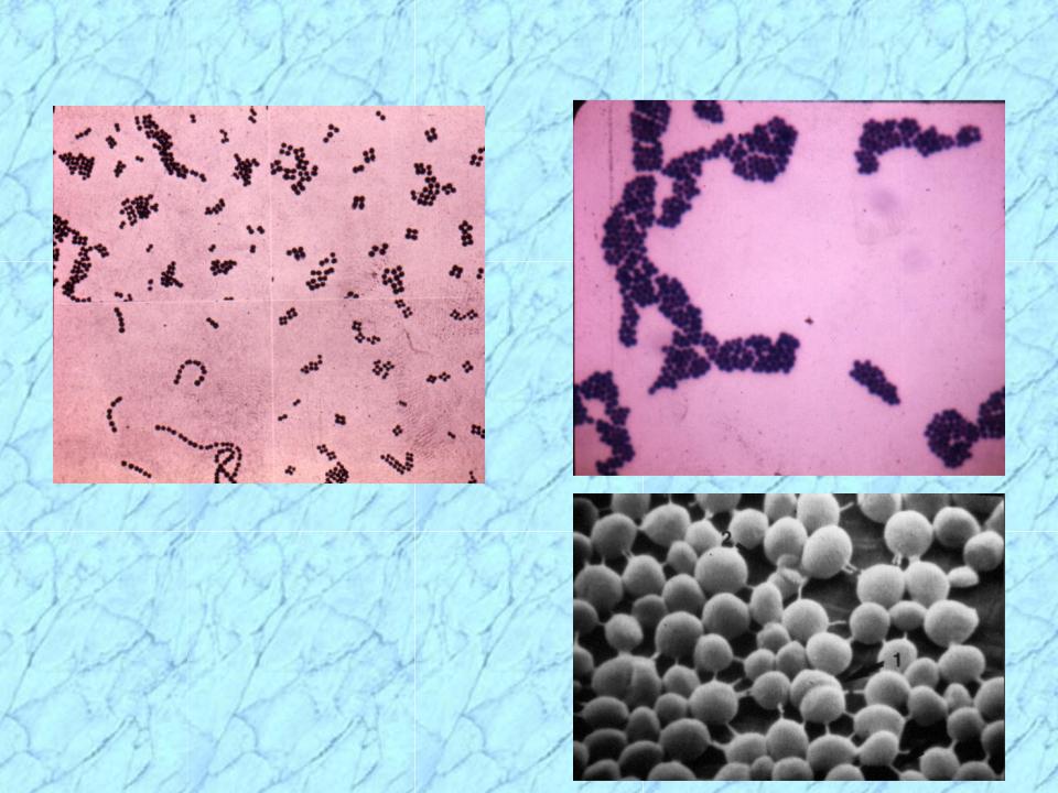 staphylococcus epidermidis gram stain