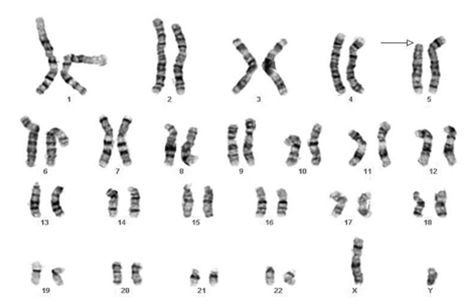 Мужская хромосома 5