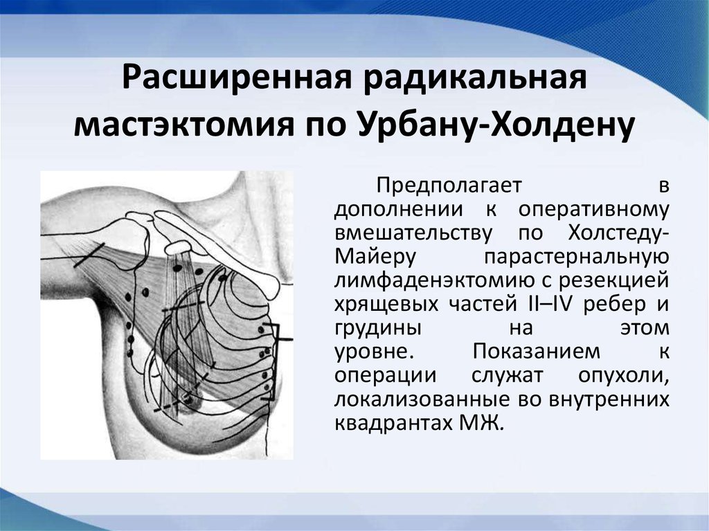 Секторальная резекция молочной железы Секторальная резекция молочной железы