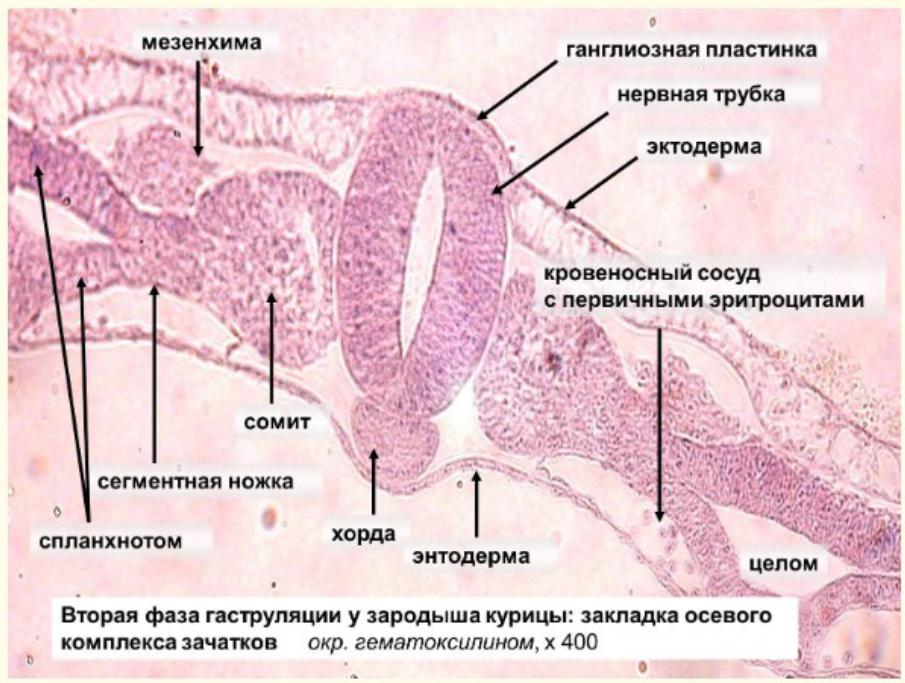 Где находятся малые половые губы. Мезенхима зародыша курицы препарат. Формирование нервной трубки гистология. Мезенхима зародыша курицы гистология. Осевой комплекс зачатков органов гистология.
