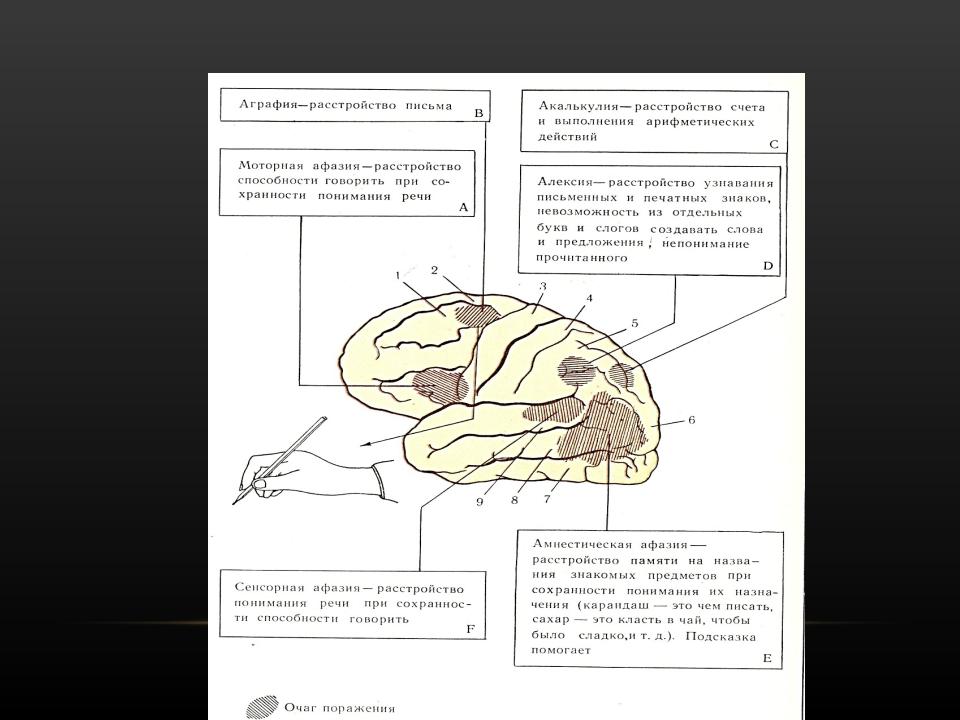 Аграфия и алексия при афазии
