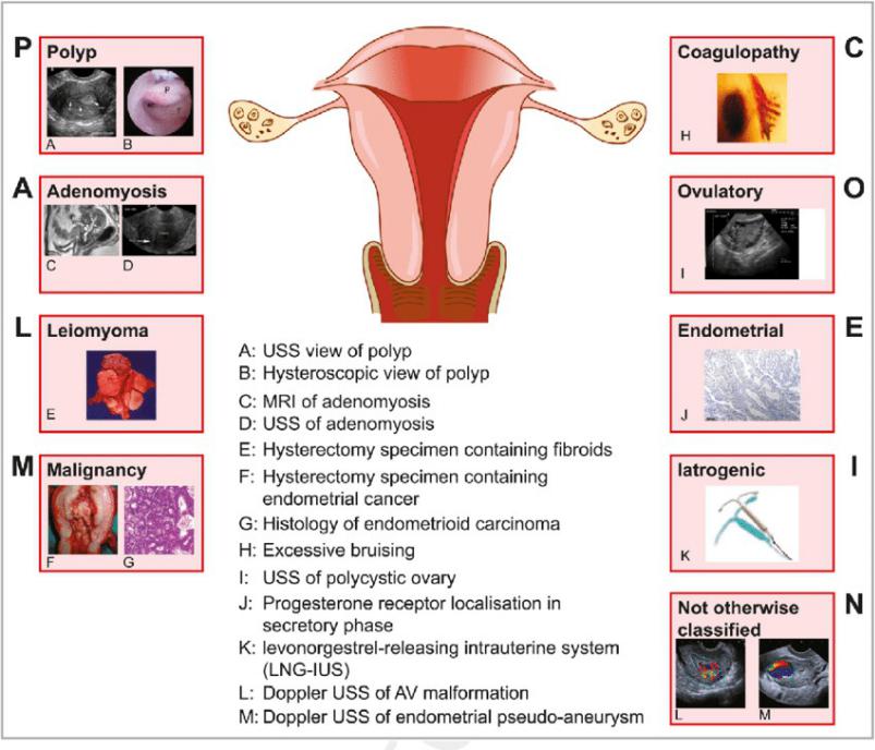 endometrium rák 1b stádium hatalmas szemölcsök