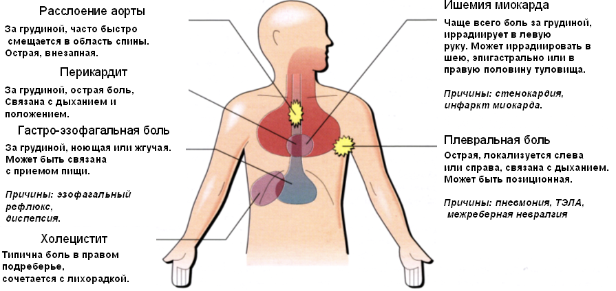 Причина боли под. Болит посередине грудины спереди. Болит верхняя часть грудной клетки посередине спереди. Боль в грудной клетке посередине причины. Болит сердце посередине грудной клетки.
