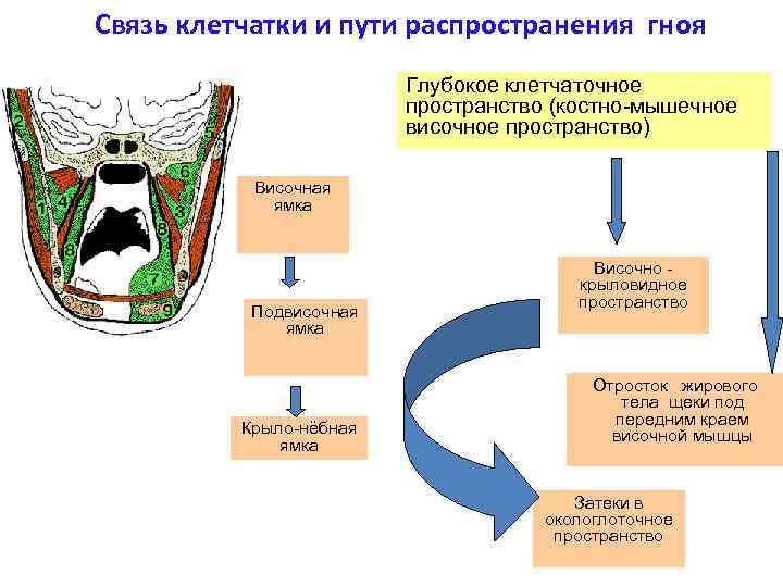 Укажите возможные пути. Пути распространения гноя. Пути распространения гнойных процессов. Пути распространения гнойных ЗАТЕКОВ. Пути распространения флегмон глубокой области лица.