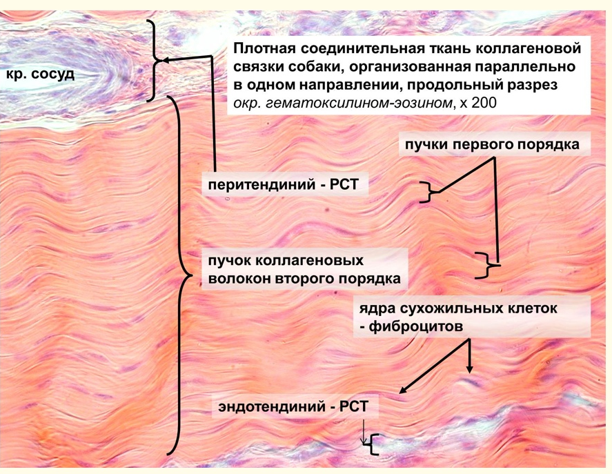 Сухожилия образованы из ткани. Плотная волокнистая соединительная ткань гистология. Плотная оформленная соединительная ткань препарат. Плотная волокнистая неоформленная соединительная ткань препарат. Плотная эластическая соединительная ткань.