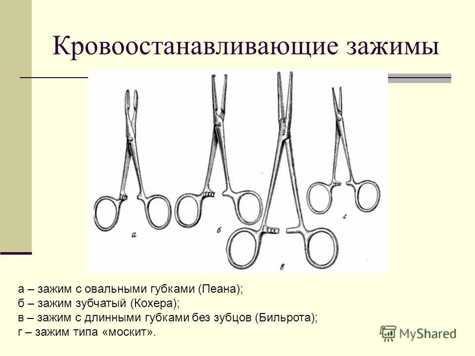 5. Выполнить переднебоковую торакотомию.