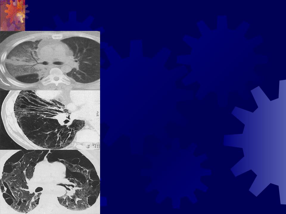 Презентация на тему: Компьютерная томография органов грудной клетки
