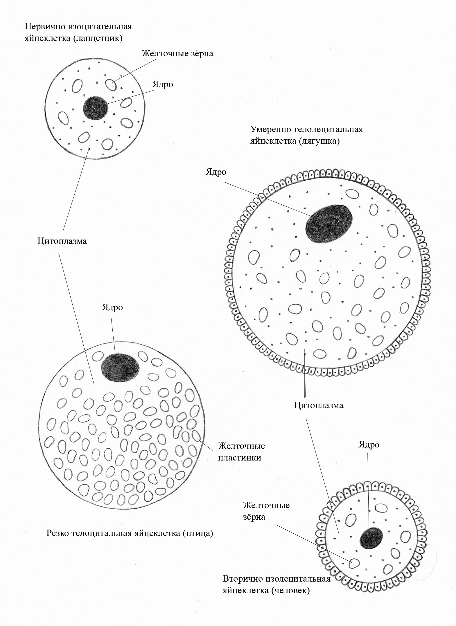 Морфология по Крюгеру (оценка внешнего строения сперматозоидов)