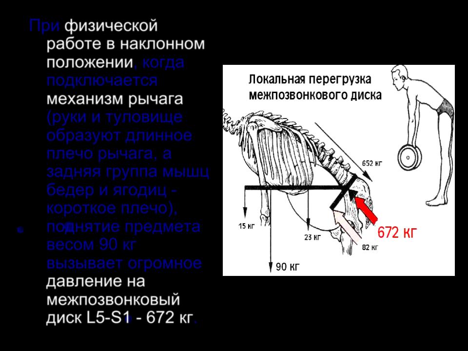 Наклонное положение. Переломы плеча механизм рычага. Работа в наклонном положении. Занятия рычаги для рук. В наклоненном положении.