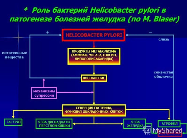 Nuevo tratamiento para helicobacter pylori