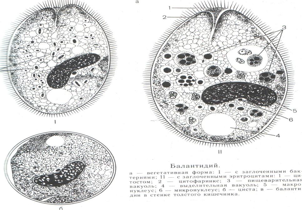 Балантидий клиническая картина