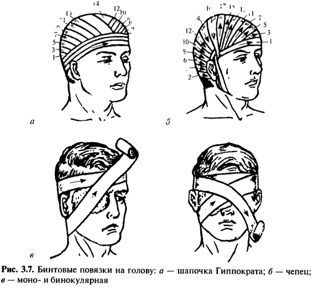 Повязки на голову