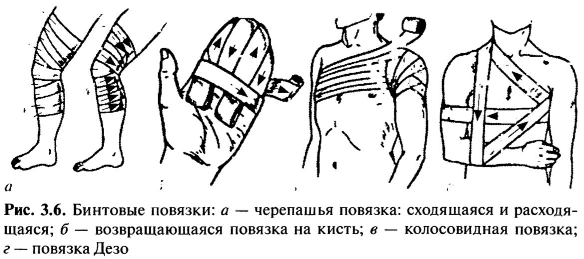 Техника наложения мягких повязок. Возвращающаяся повязка техника наложения. Техника бинтования десмургия. Десмургия возвращающаяся повязка на кисть. Колосовидная повязка хирургия.