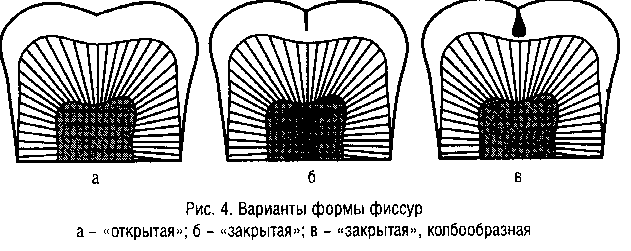 Этапы лечения кариеса зубов пропедевтика